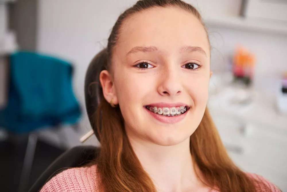 Teeth Braces Price in Lahore